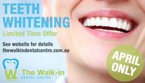 Dentist Teeth Whitening Offer April 2019