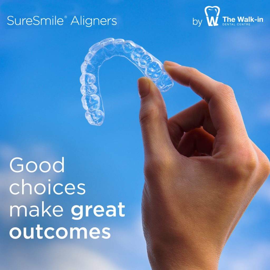 SureSmile Clear Aligners